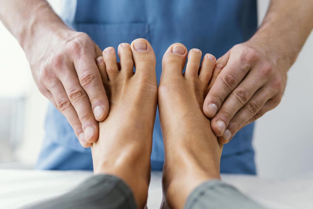 Bunion Surgery: When Is the Right Time to Consider It?